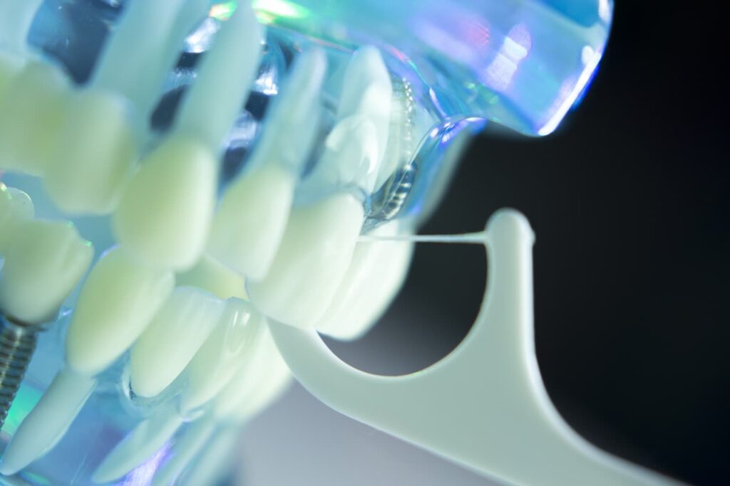 Dental implants by samuel jirik DDS